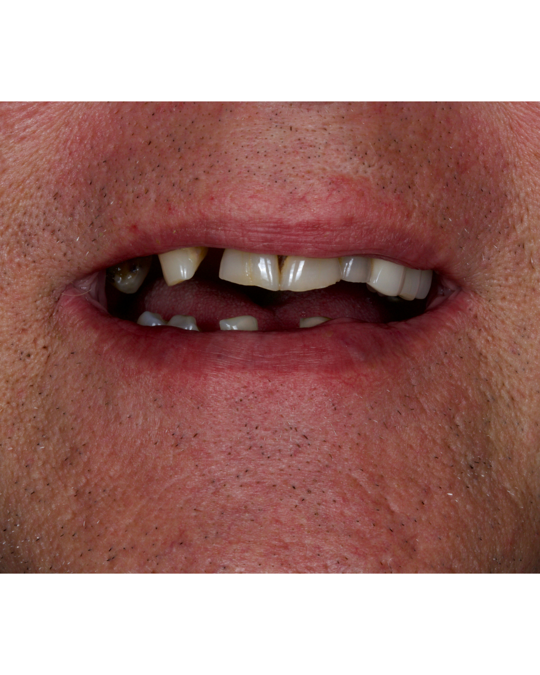 Pre-treatment smile condition