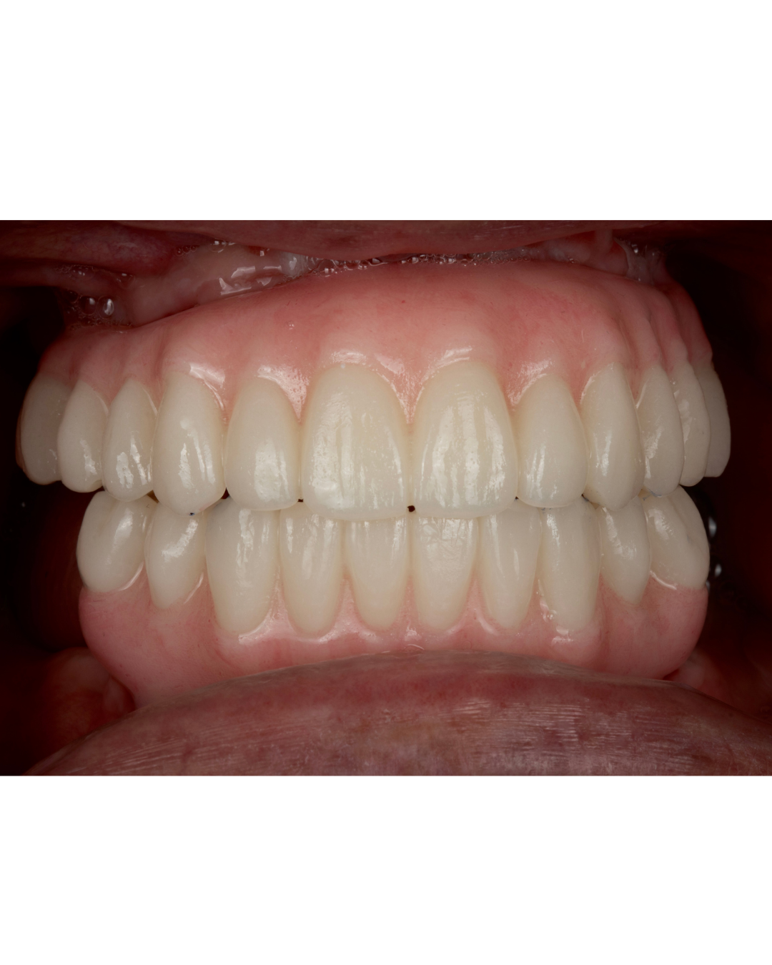 Complex Rehabilitation — result