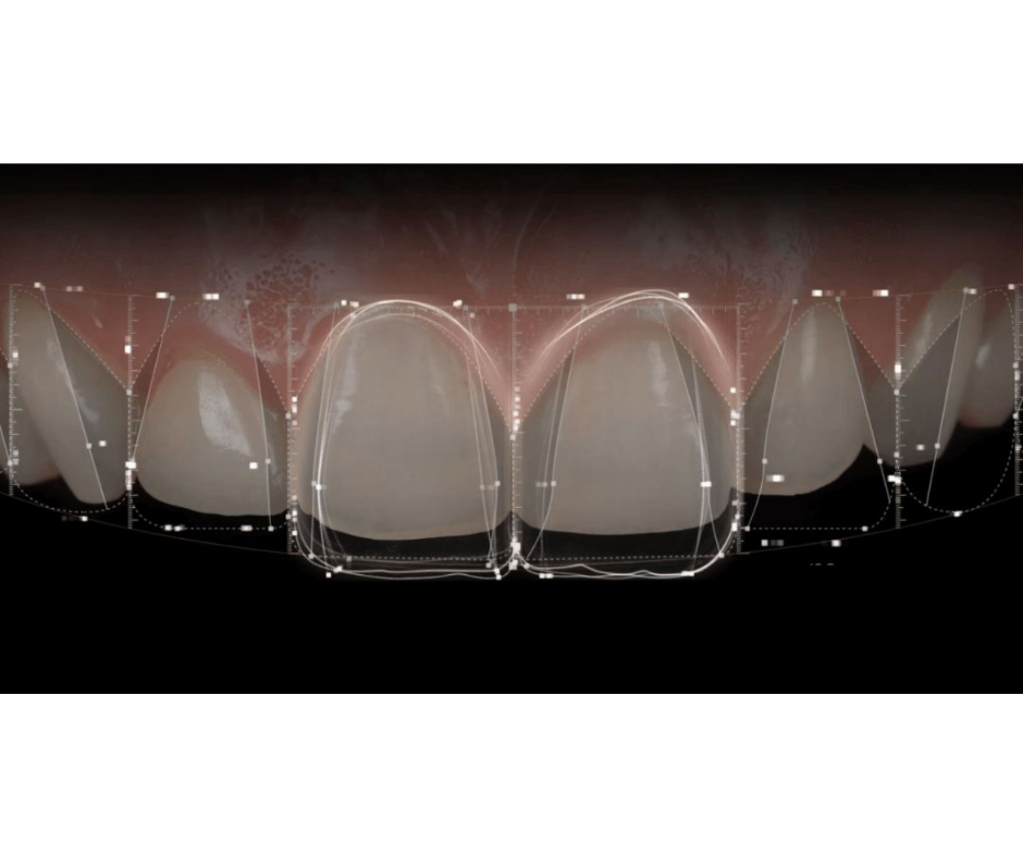 Digital Facial & Tooth Analysis