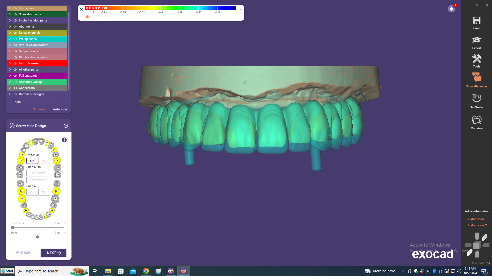 Digitally Engineered Outcome
